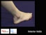 Anterior Ankle Joint.mov